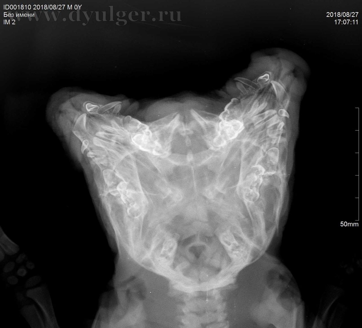 Рентгенография области головы