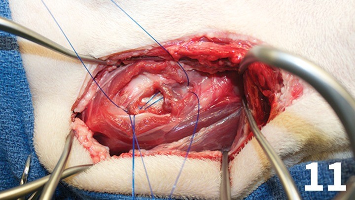 prop_laryngeal-surgery_figure-11-26026-gallery