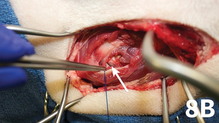 prop_laryngeal-surgery_figure-8b-26026-gallery