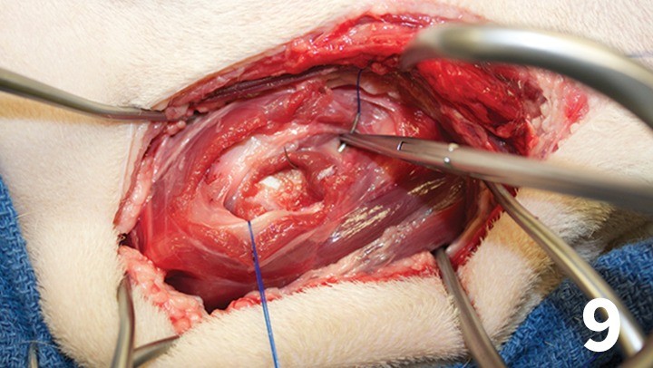prop_laryngeal-surgery_figure-9-26026-gallery